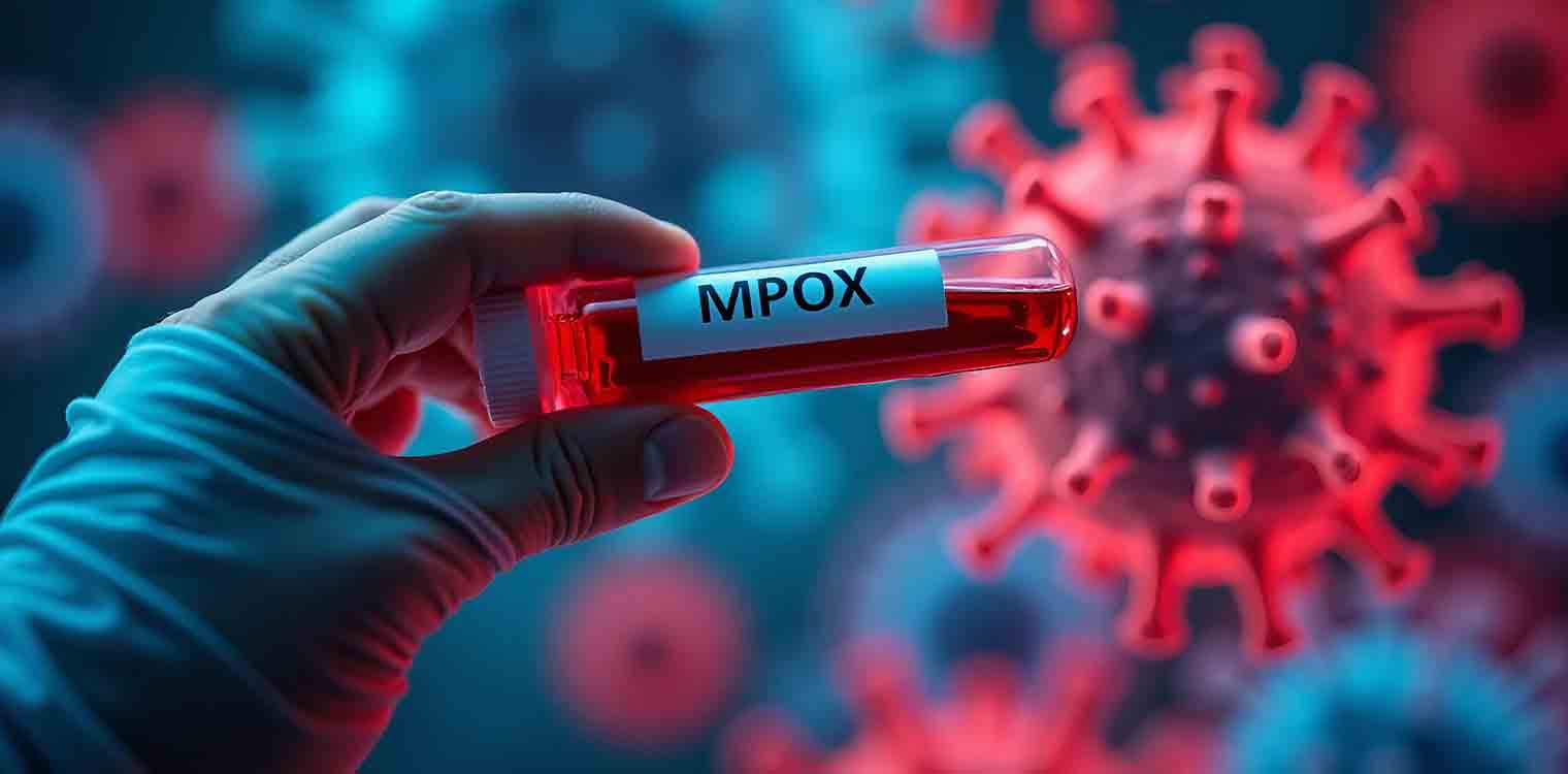 Γερμανία: Περισσότερα κρούσματα mpox έχουν εμφανιστεί στην Ευρώπη από όσα έχουν ανακοινωθεί, λέει ο CEO της Roche