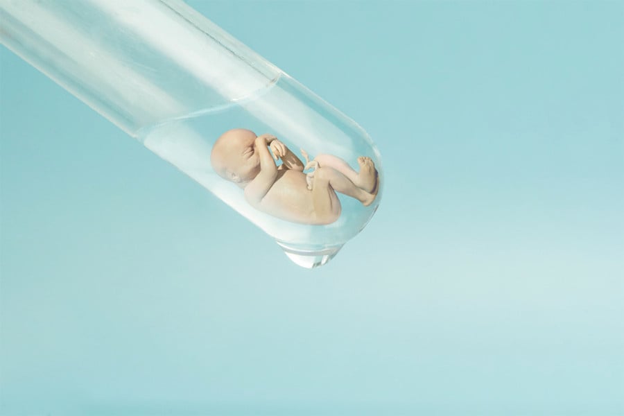 Mini IVF: όλα όσα πρέπει να γνωρίζετε για τη μέθοδο εξωσωματικής γονιμοποίησης